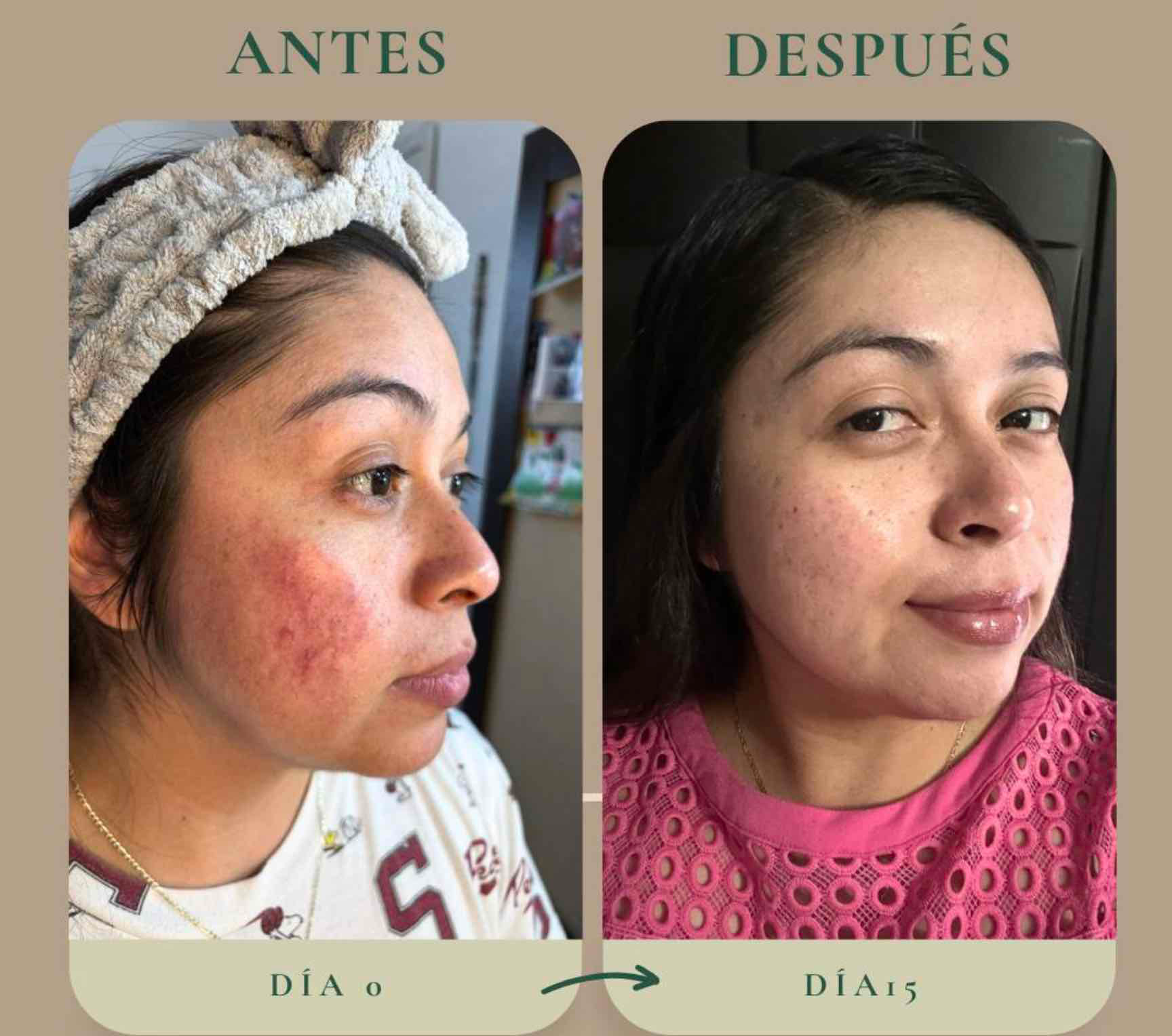 Antes y después — caso 3