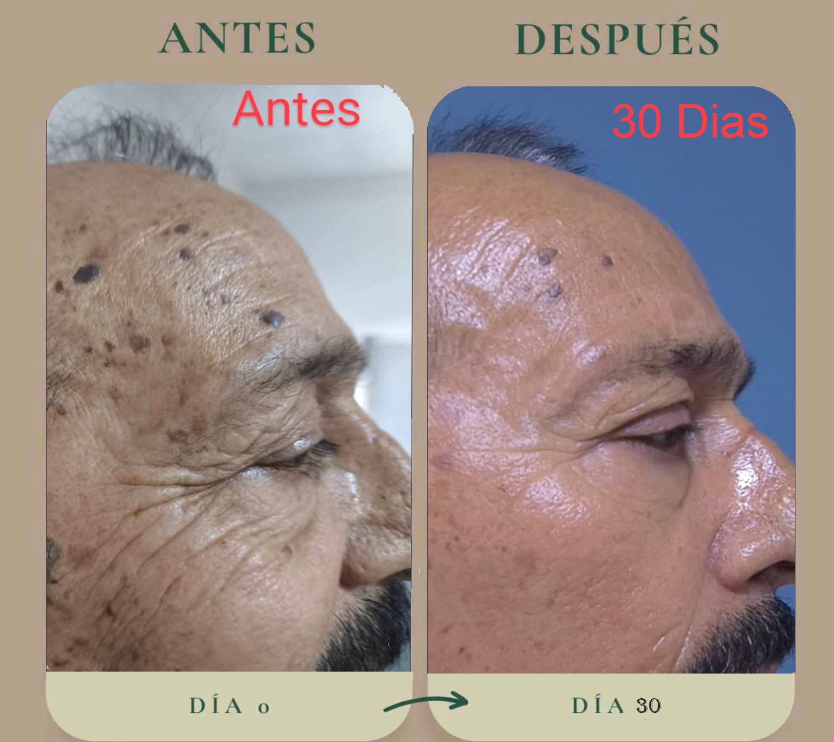 Antes y después — caso 5